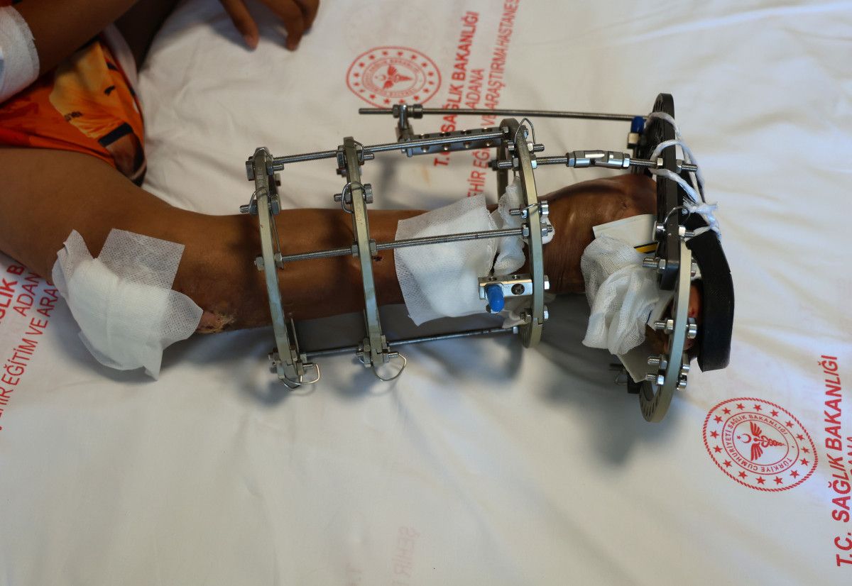 İNŞALLAH YAKIN ZAMANDA AYAĞININ ÜZERİNE BASABİLECEK