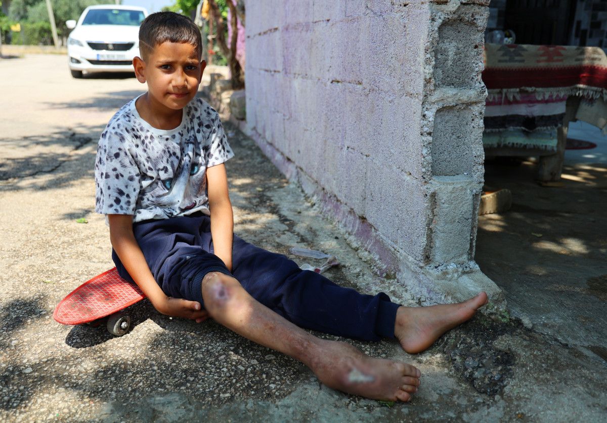 Adana'da Kaykayla Hayatını Sürdürürken Artık Yürüyor: Serdal'ın Dönüşüm Hikayesi