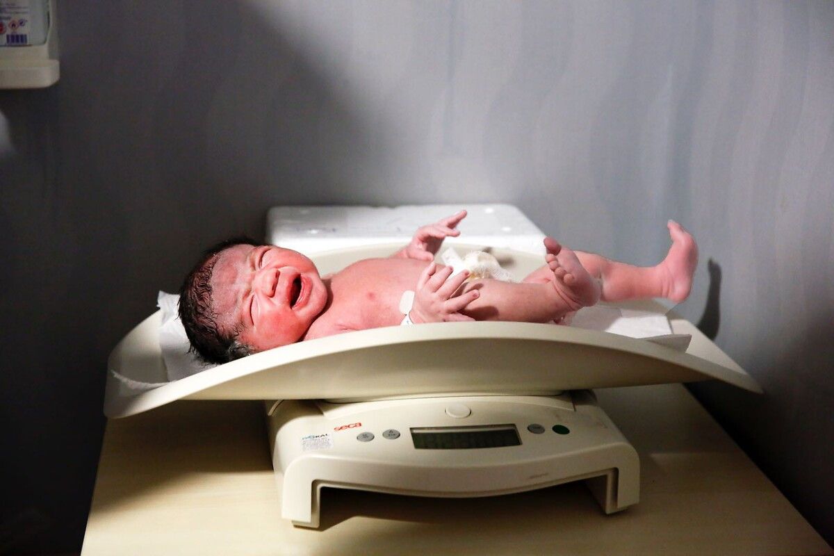 Bebeğin Tepkisi ve Takibi