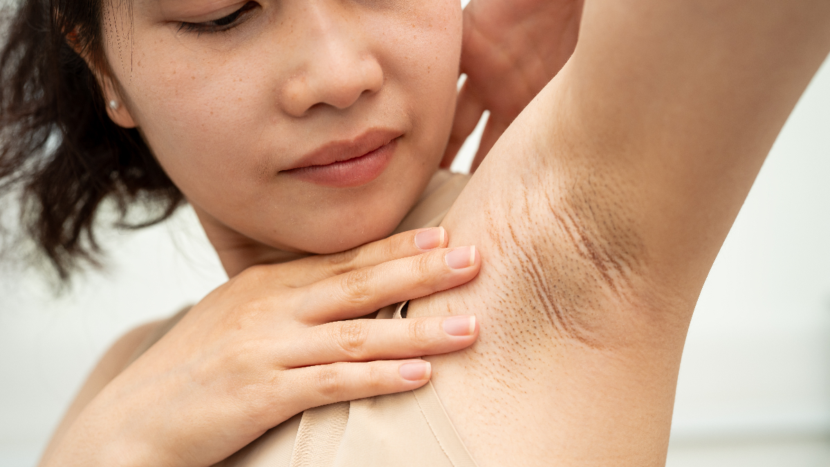 Yaz Aylarında Ter Kokusu ve Çözüm Yolları