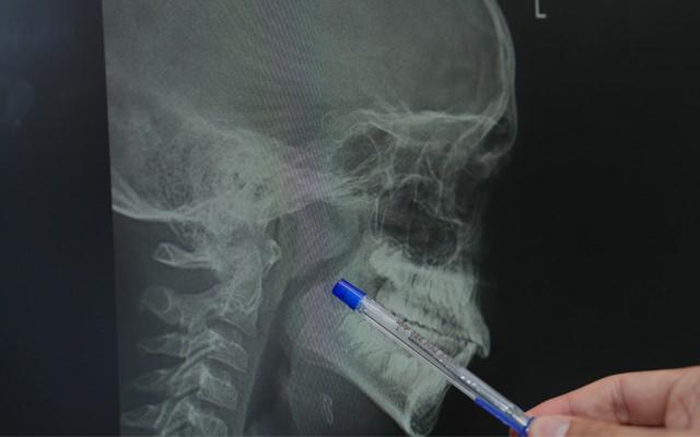 Çocuklarda Bademcik ve Geniz Eti Problemlerinde Erken Tanı ve Müdahalenin Önemi