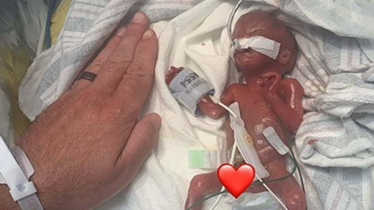 ABD'nin Iowa Eyaletinde Dünyaya Gelen Nash Keen, Tarihe Geçti