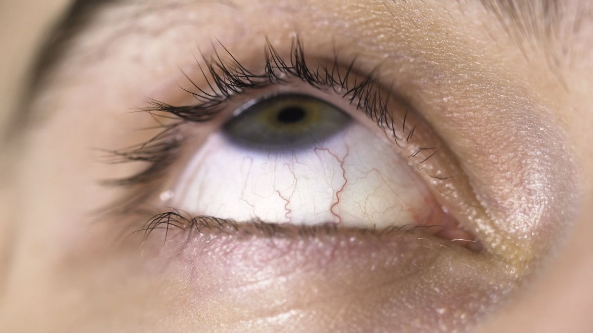 1. Alerjik Reaksiyonlar