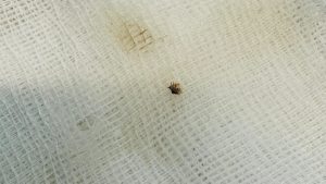 Kahramanmaraş’ta Kene Vakası ve Sağlık Uyarıları