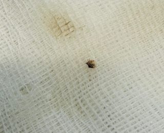 Kahramanmaraş’ta Kene Vakası ve Sağlık Uyarıları