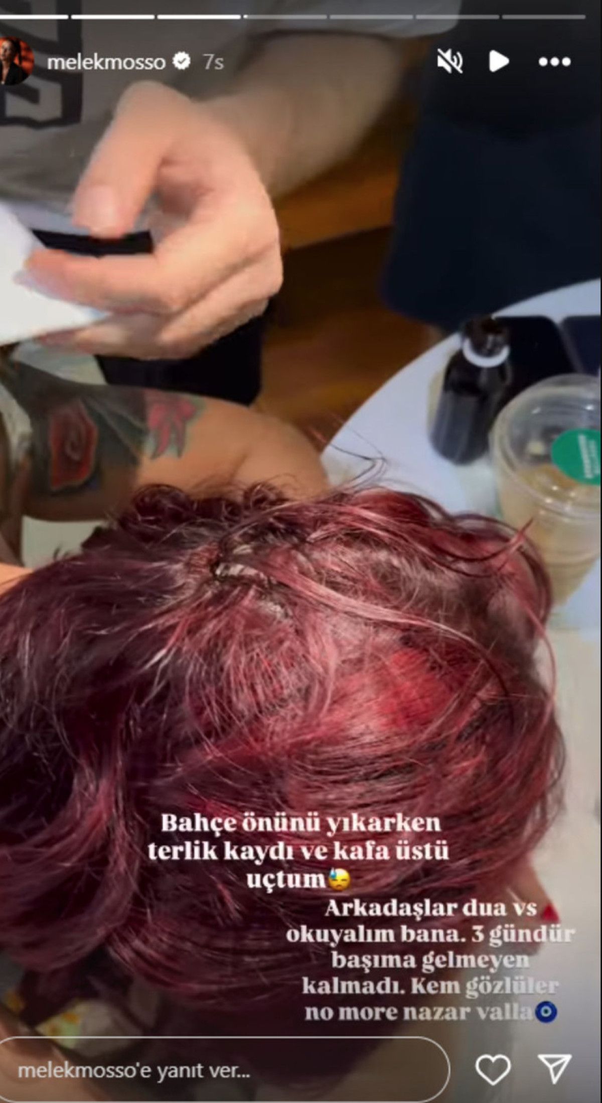 Şarkıcı Melek Mosso'nun Ev Kazası: Dualarınızı Esirgemeyin