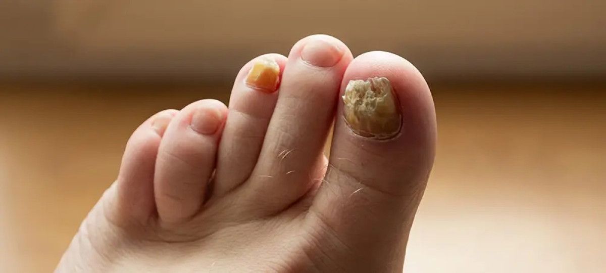 İki Malzeme ile Mucizevi Tedavi