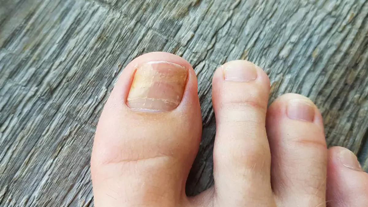 İki Malzeme ile Mucizevi Tedavi