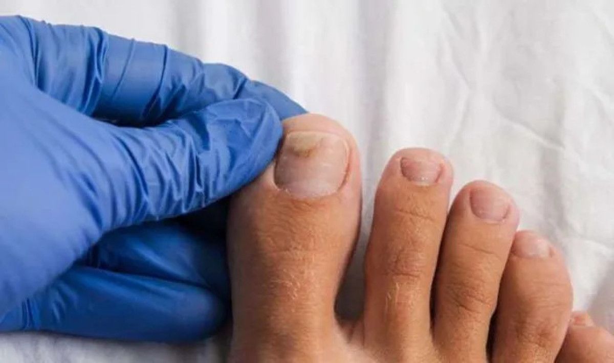 İki Malzeme ile Mucizevi Tedavi