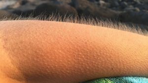 Tüylerin Diken Diken Olmasının Bilimsel Sebepleri ve Gizemi