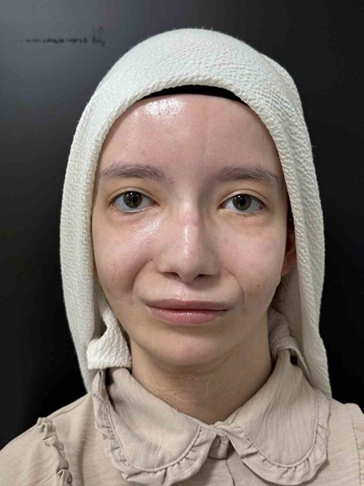 Ülkemizde Bir İlkin Gerçekleşti