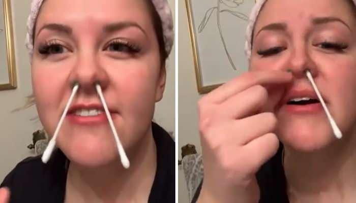 Burnundaki Kılı Koparan Kadının Şoke Eden Hikayesi ve Burun Kılı Koparmanın Riskleri