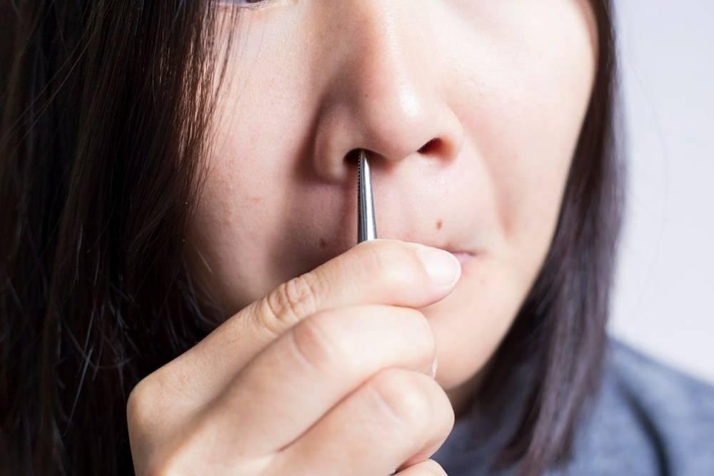 Burnundaki Kılı Koparan Kadının Şoke Eden Hikayesi ve Burun Kılı Koparmanın Riskleri