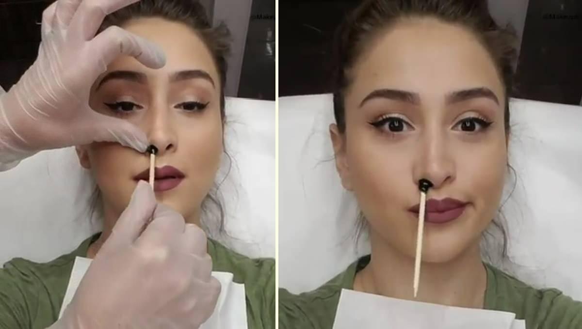 Burnundaki Kılı Koparan Kadının Şoke Eden Hikayesi ve Burun Kılı Koparmanın Riskleri