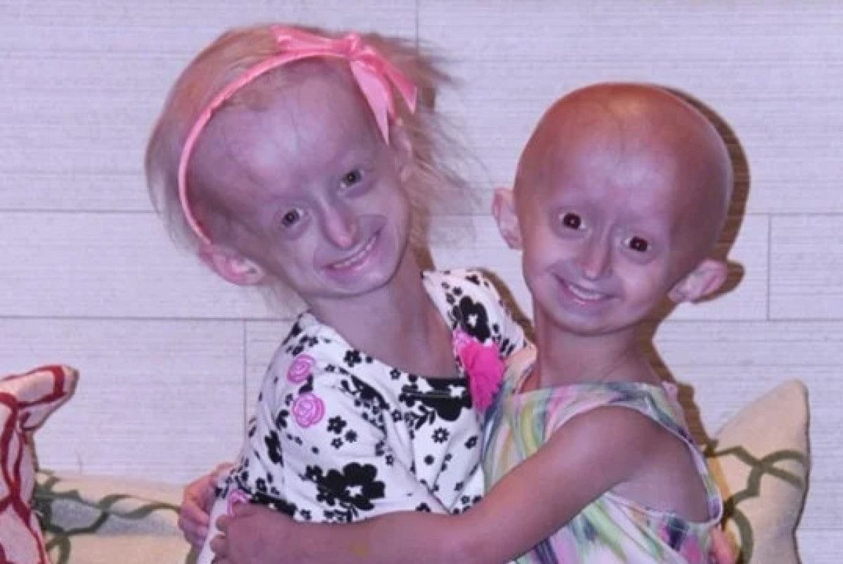 Zihinsel ve Bilişsel Yetenekler