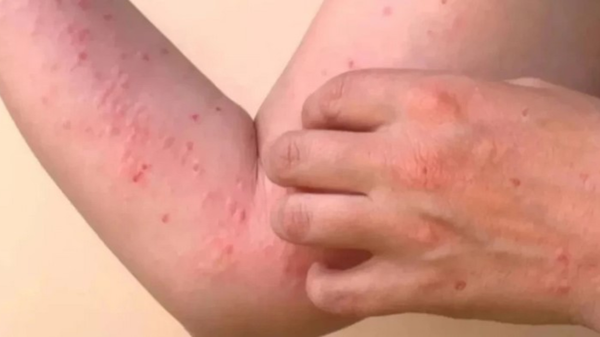 Dünyada Yaygınlaşma ve Riskler