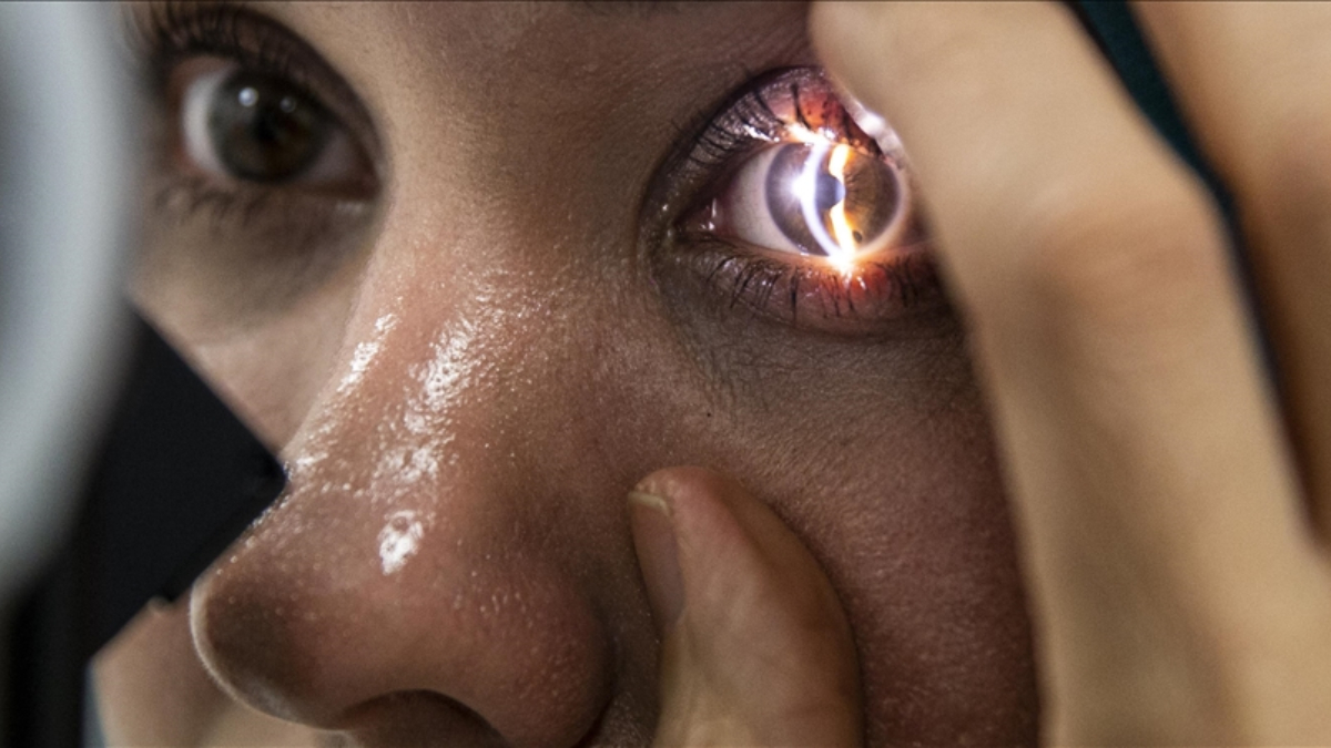 ABD’deki Amerikan Kimya Derneği Toplantısında Sunulan Yeni Göz Şekillendirme Yöntemi