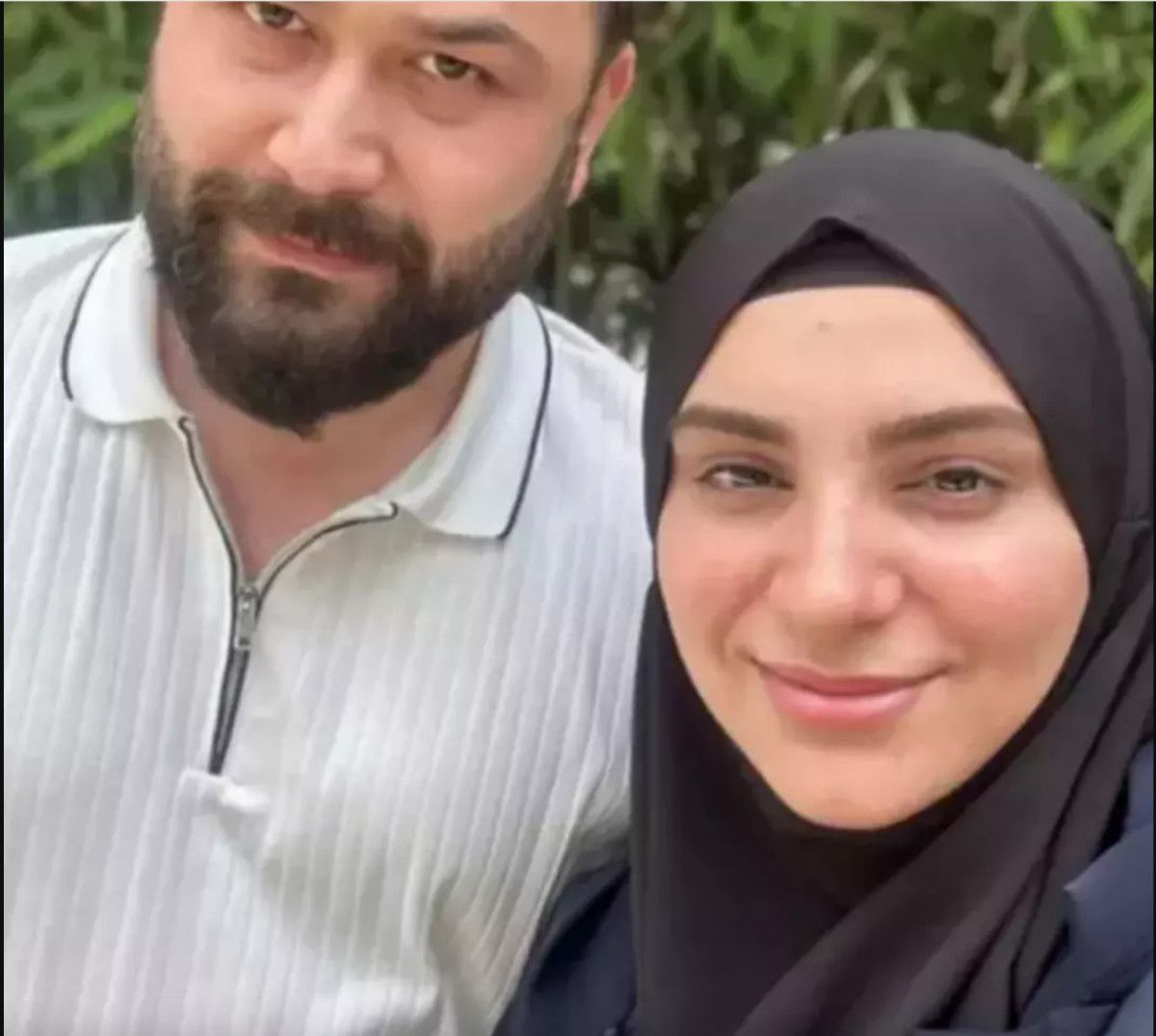 Popstar Özlemin Son Haliyle Hayrete Düşürdü: Başörtüsünü Çıkardı ve Estetik Yaptırdı!