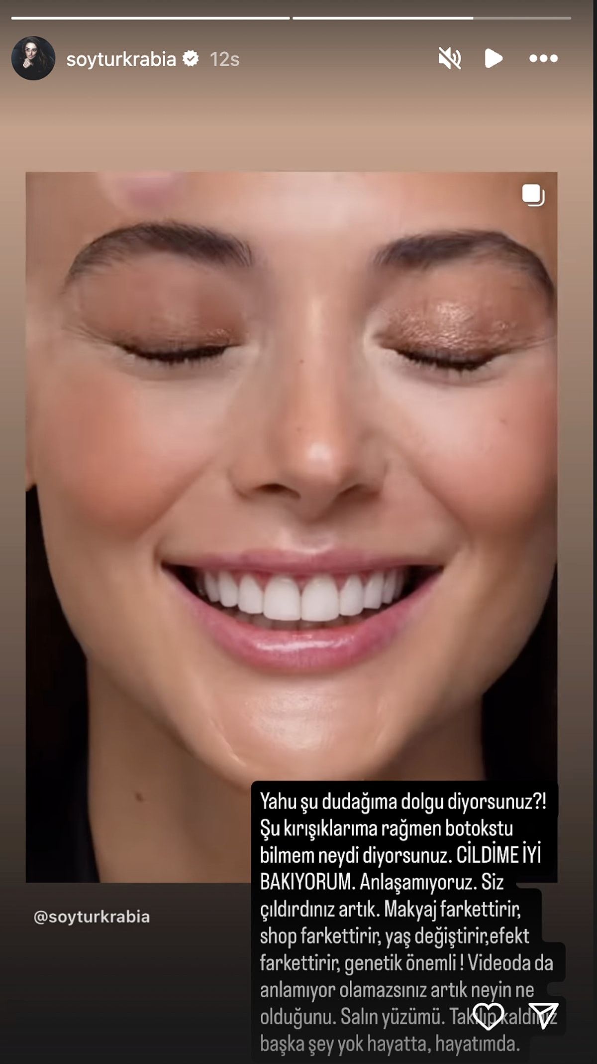 Rabia Soytürk'ten Estetik İddialarına Net Yanıt