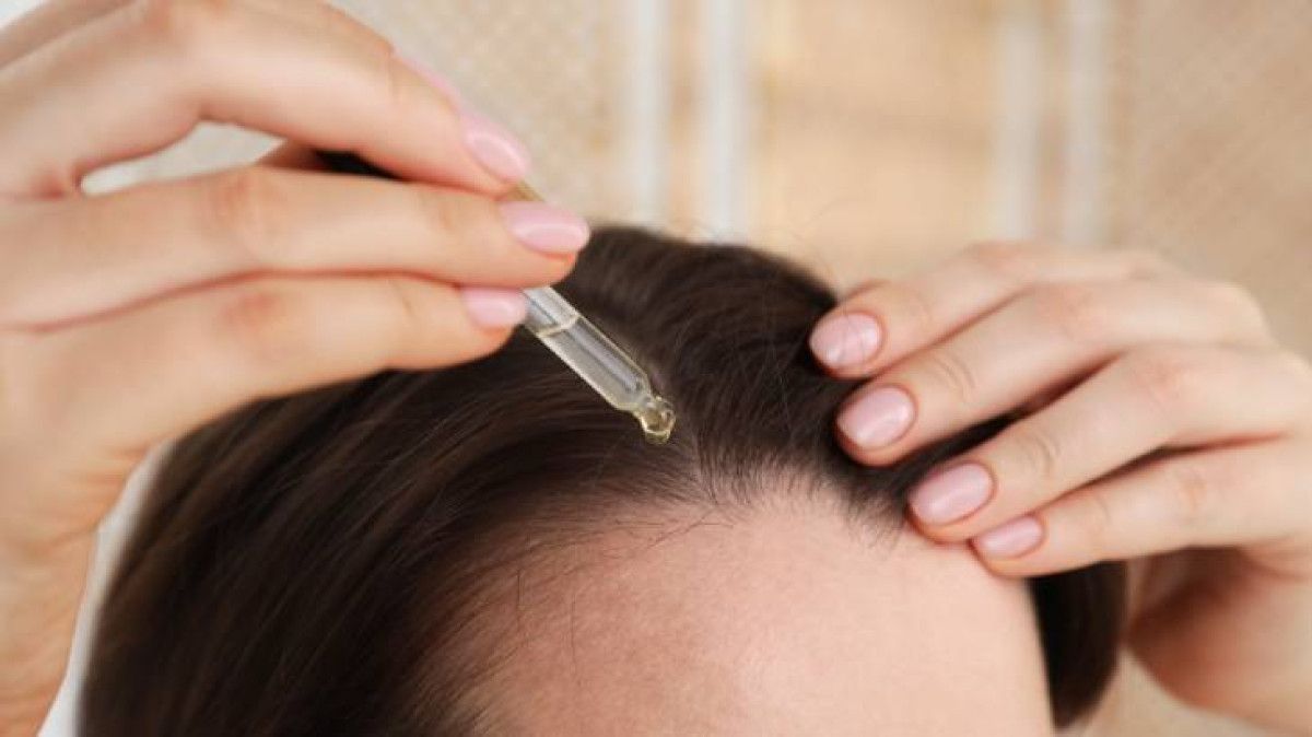 Saç Egzaması Nedenleri ve Tedavi Yöntemleri: Saçta Egzama Nasıl Geçer?