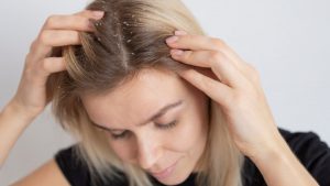 Saç Egzaması Nedenleri ve Tedavi Yöntemleri: Saçta Egzama Nasıl Geçer?