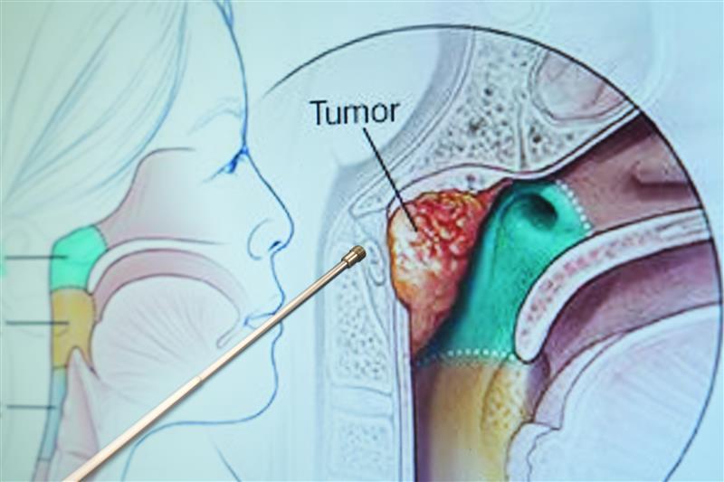 Belirtilerin Seyri ve Ciddiyeti