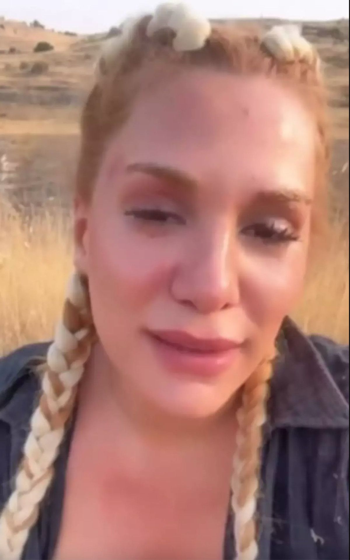 Survivor Almeda Baylan'ın Trafik Kazasından Sonra Aracının Durumu İlk Kez Gösterildi