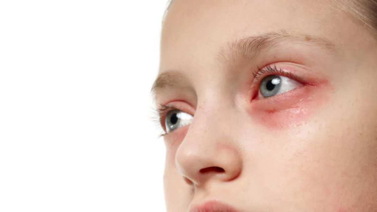 Deniz ve Göz Sağlığı