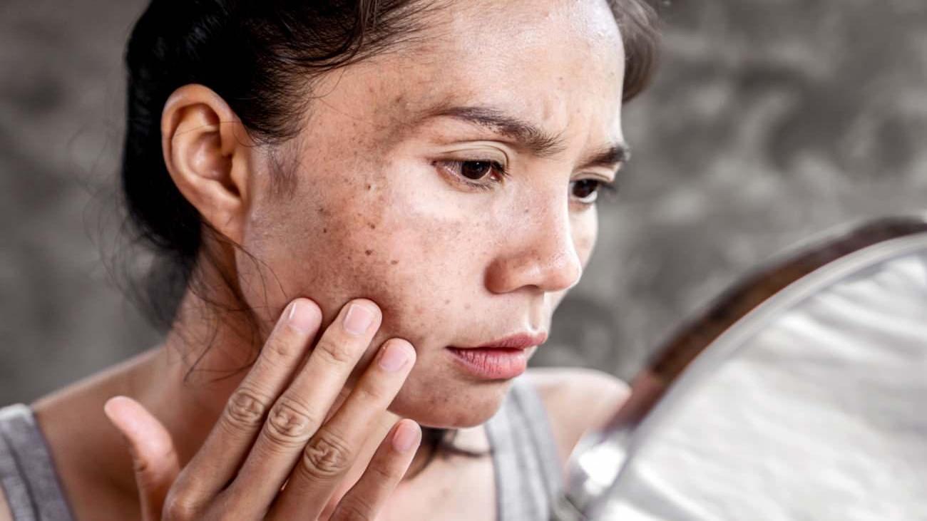 Güneş Koruma ve Sürdürülebilir Cilt Sağlığı İçin Alınacak Önlemler