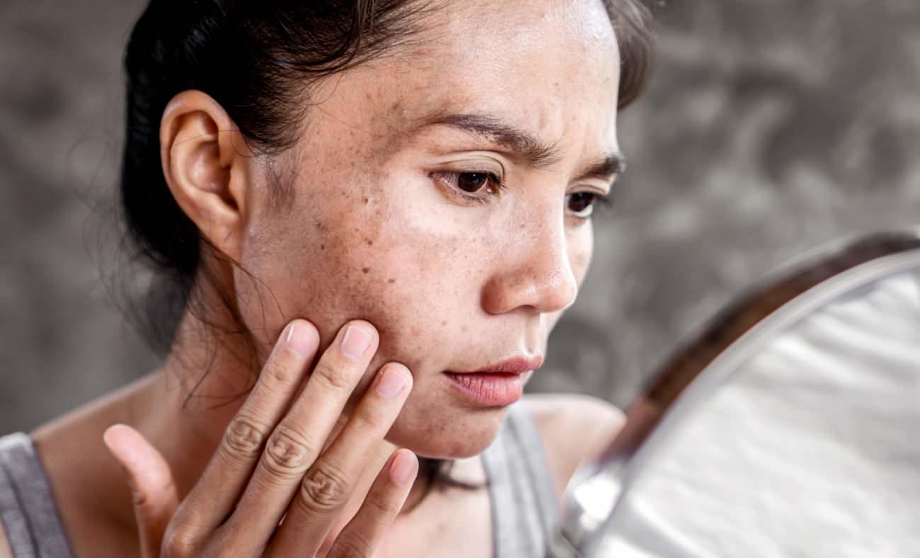 Güneş Koruma ve Sürdürülebilir Cilt Sağlığı İçin Alınacak Önlemler