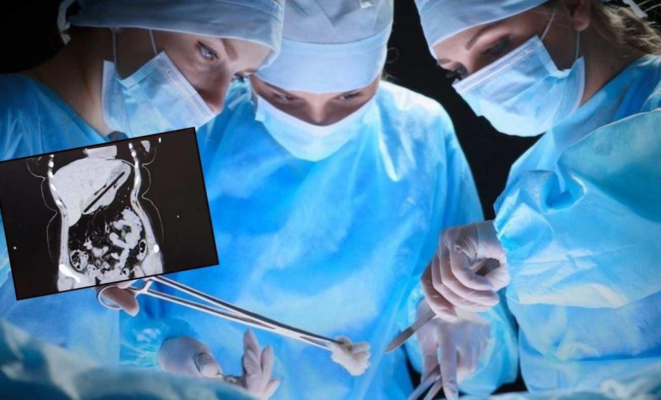 Ağrı Şikayetiyle Gelen Hasta Ameliyat Edildi: Midesinden Çıkan Şey Globe Oldu!