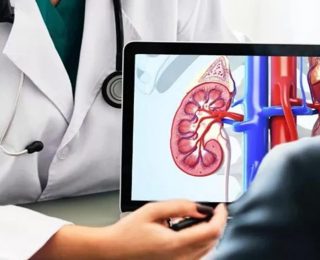 Böbrek Tümörlerinde Robotik Cerrahi: Süre Azaldı, İyileşme Hızlandı!