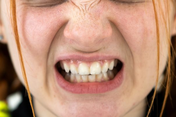 Diş Sıkma Alışkanlığı ve Migren Arasındaki Bağlantı: Gereken Önlemler