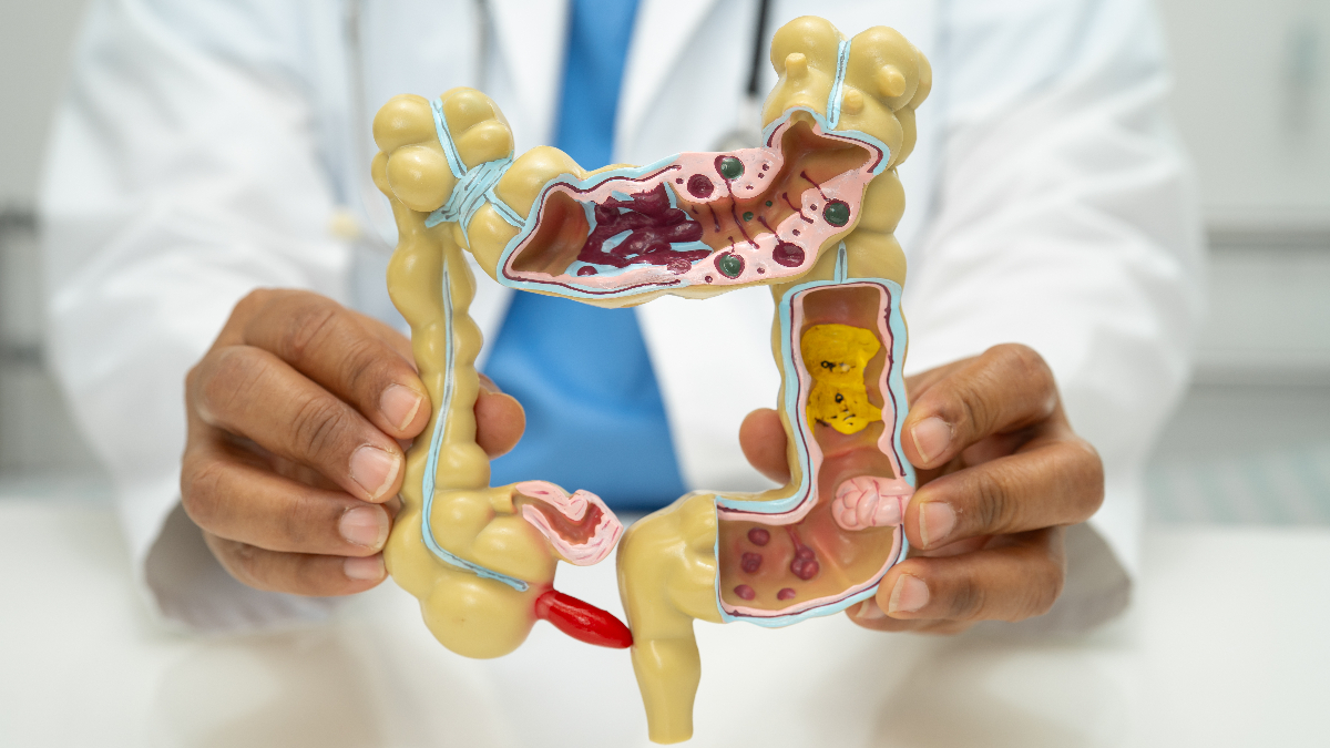 Apandisit Kanseri Riskini Azaltmak İçin Tavsiyeler