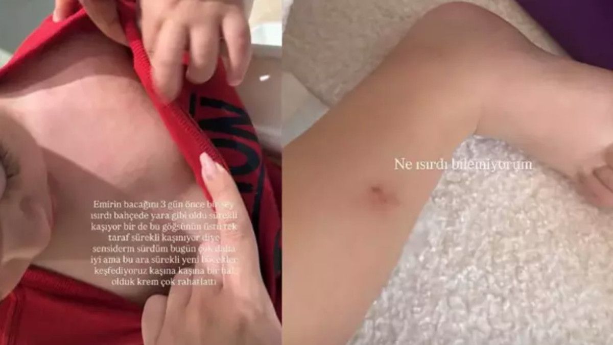 İbrahim Tatlıses'in İkiz Torunları Şaşırtıyor! Yasemin Şefkatli Rahatsızlık Detaylarını Paylaştı