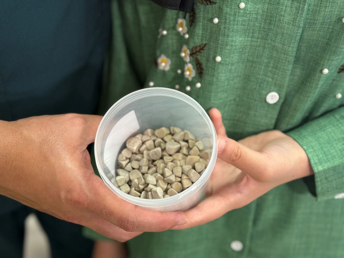 İstanbul'da Karın Ağrısıyla Giden Hasta, Vücudundan 287 Taş Çıkardı