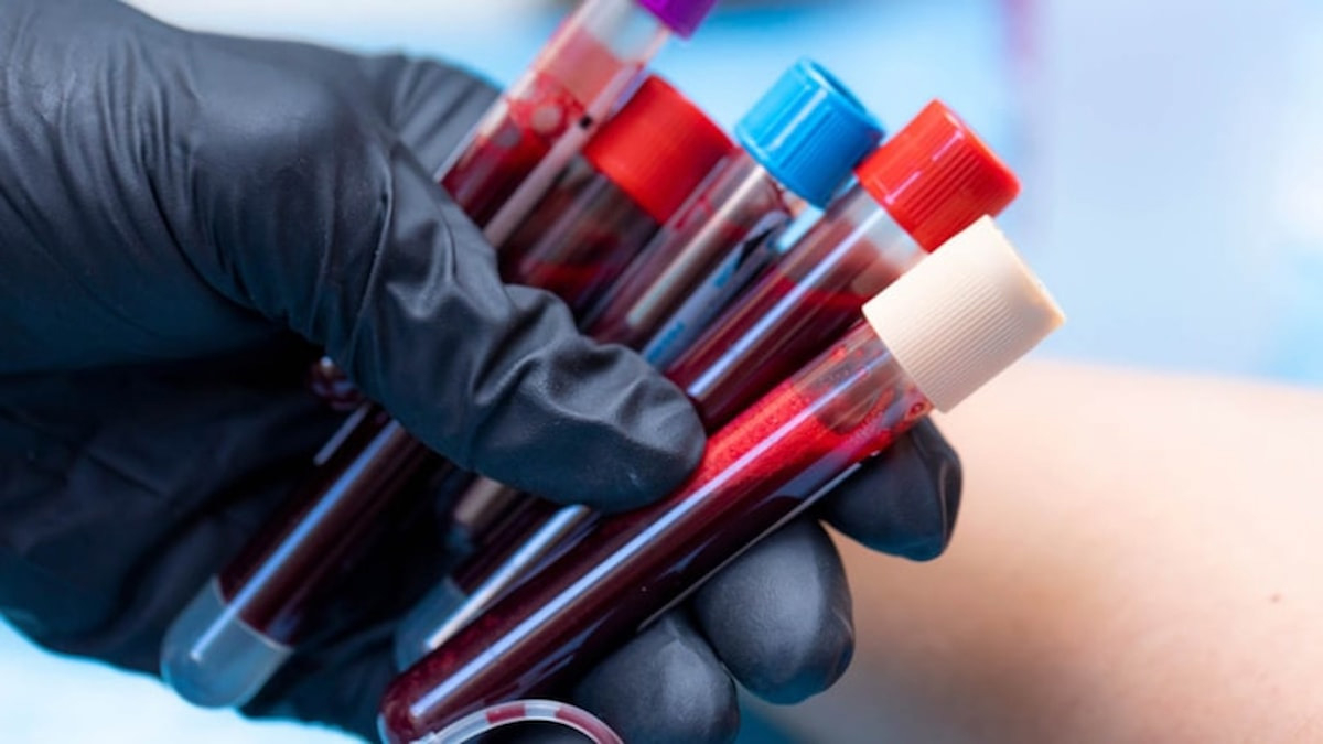 Kan Grubuna Göre İş ve Kariyer Tercihleri