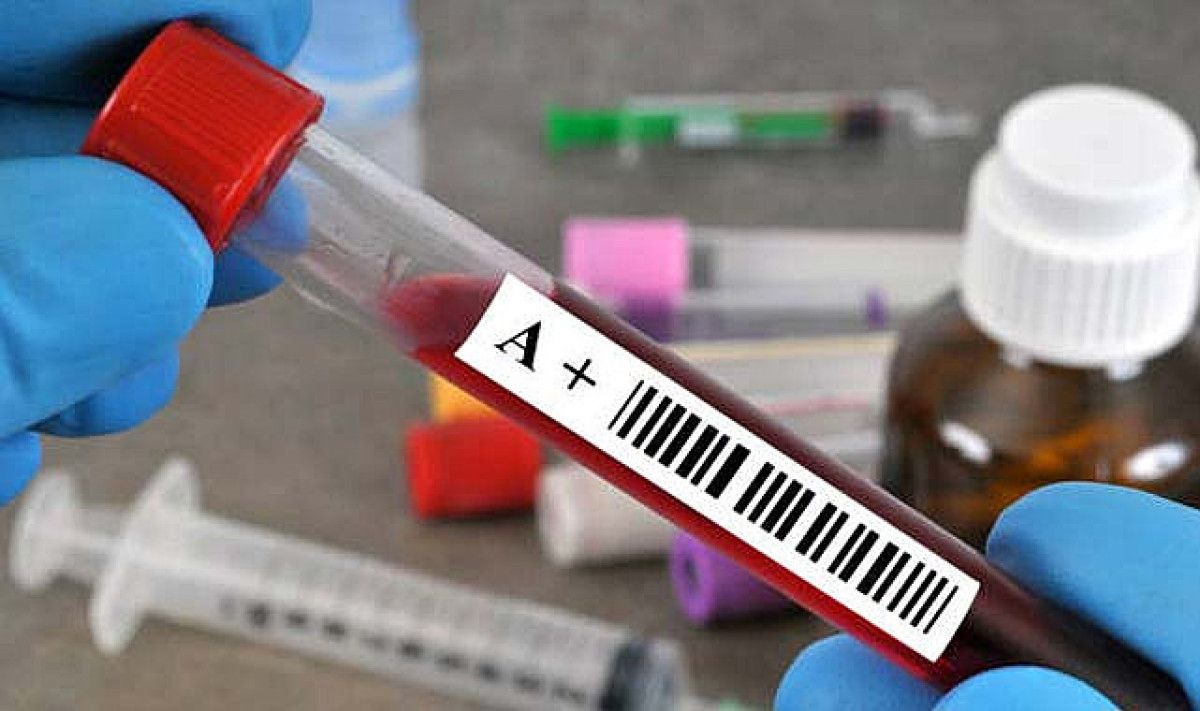 B Grubu: Yaratıcı ve Bağımsız