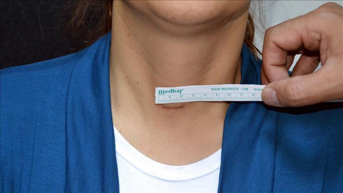 Fark edilmesi Zorlenen Belirtiler