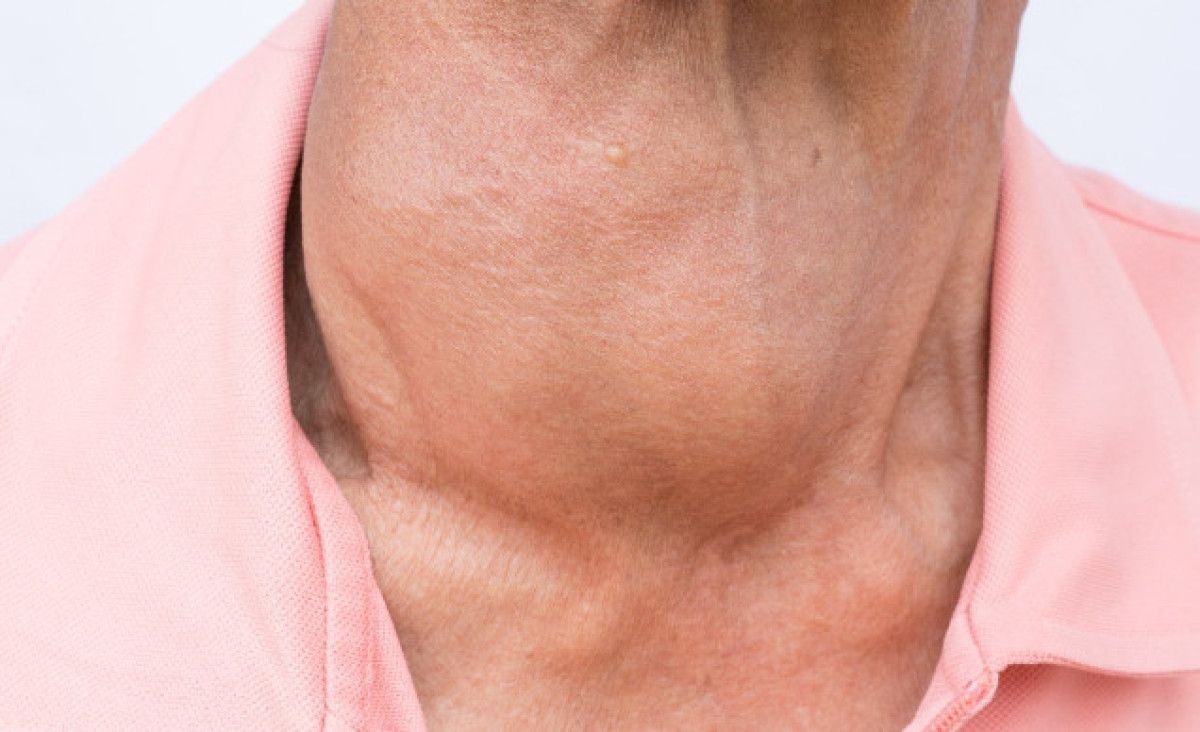 Kadınlarda Daha Sık Görülen Tiroid Hastalığına Dair Bilmeniz Gerekenler