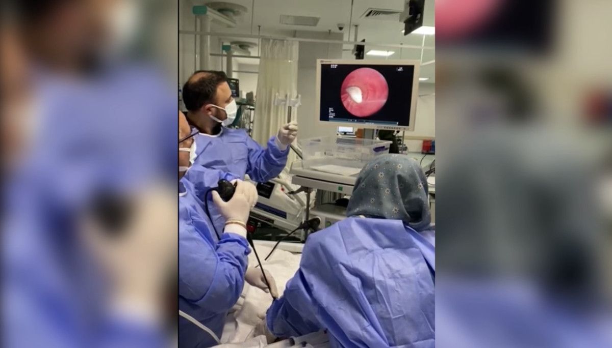 Osmaniye'de Akciğere Kaçan Sarımsağın Operasyonla Çıkarılması