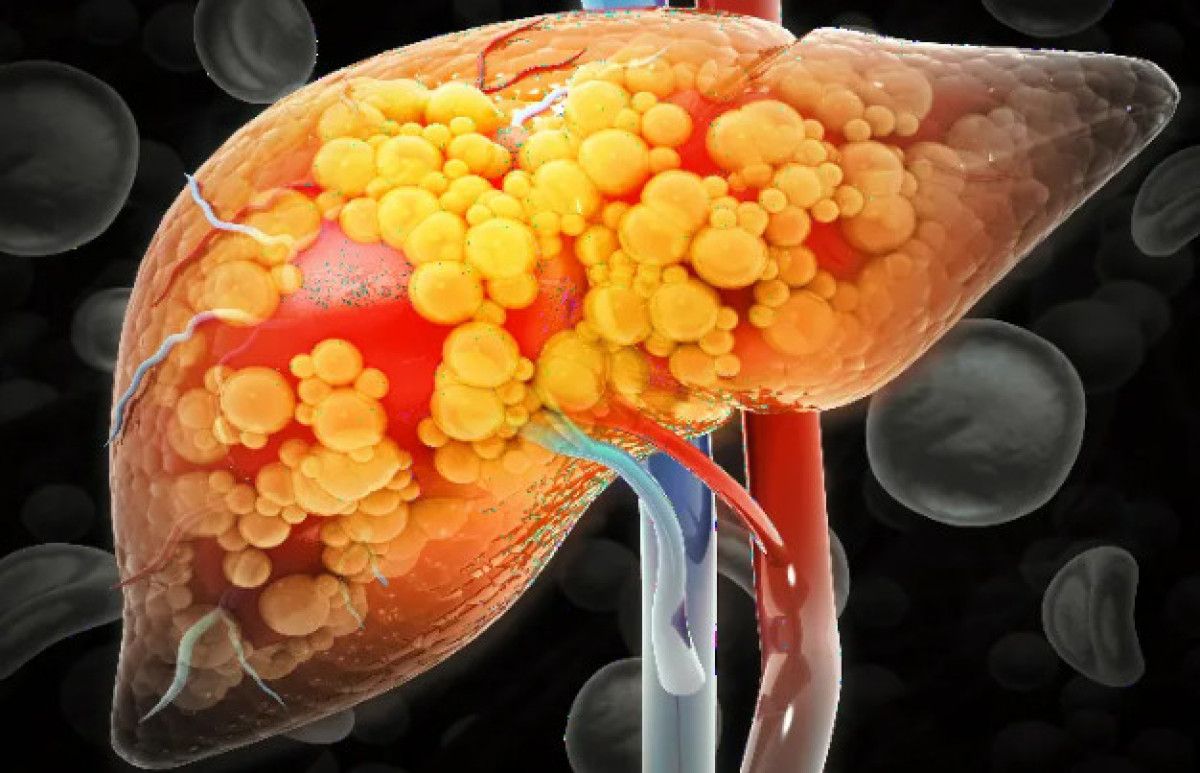 Yağlanmanın Oluşturduğu Sağlık Problemleri