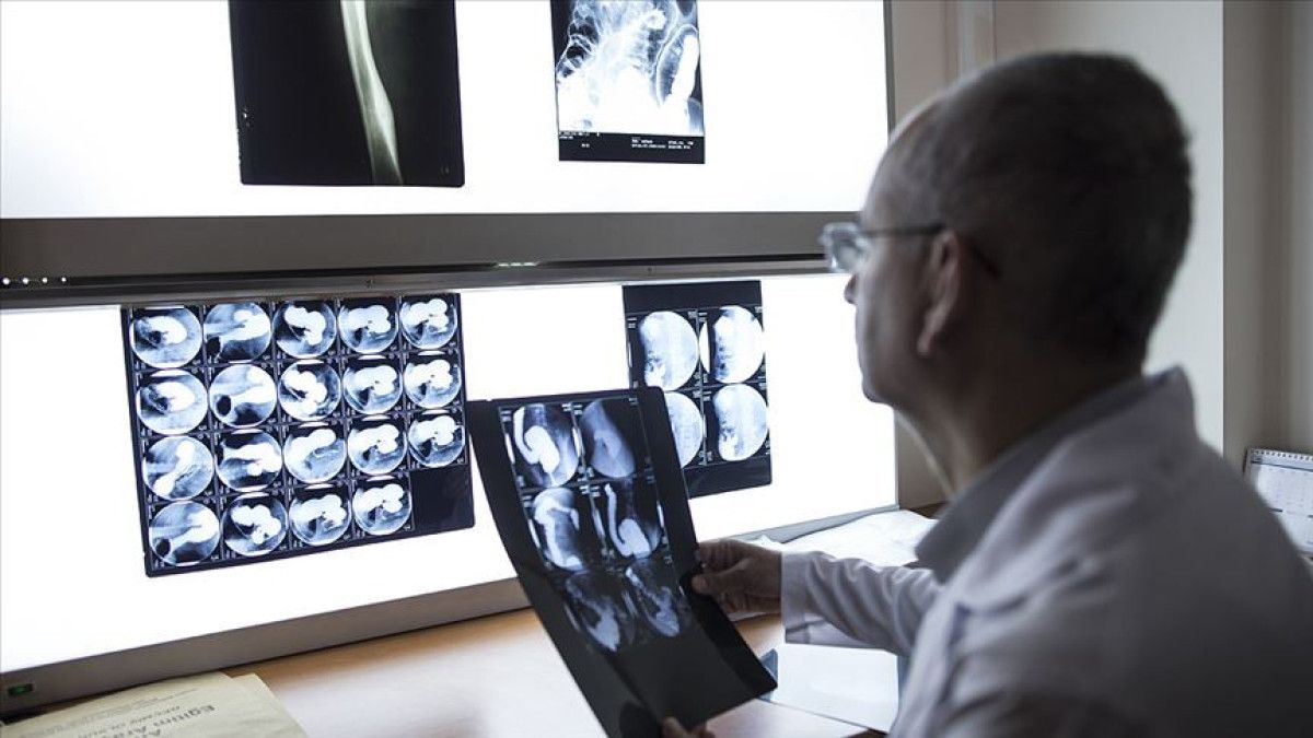 Sigara İçmenin 16 Kanser Türüne Neden Olma Riski