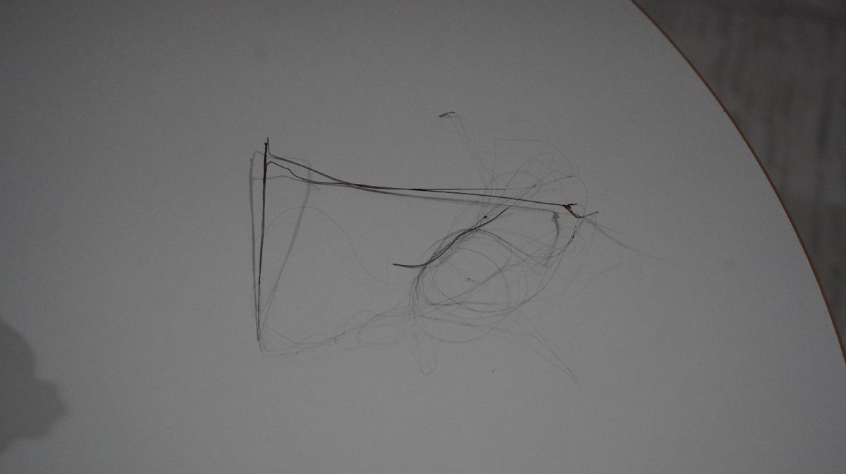 Ameliyat ve Tele Müdahale Süreci