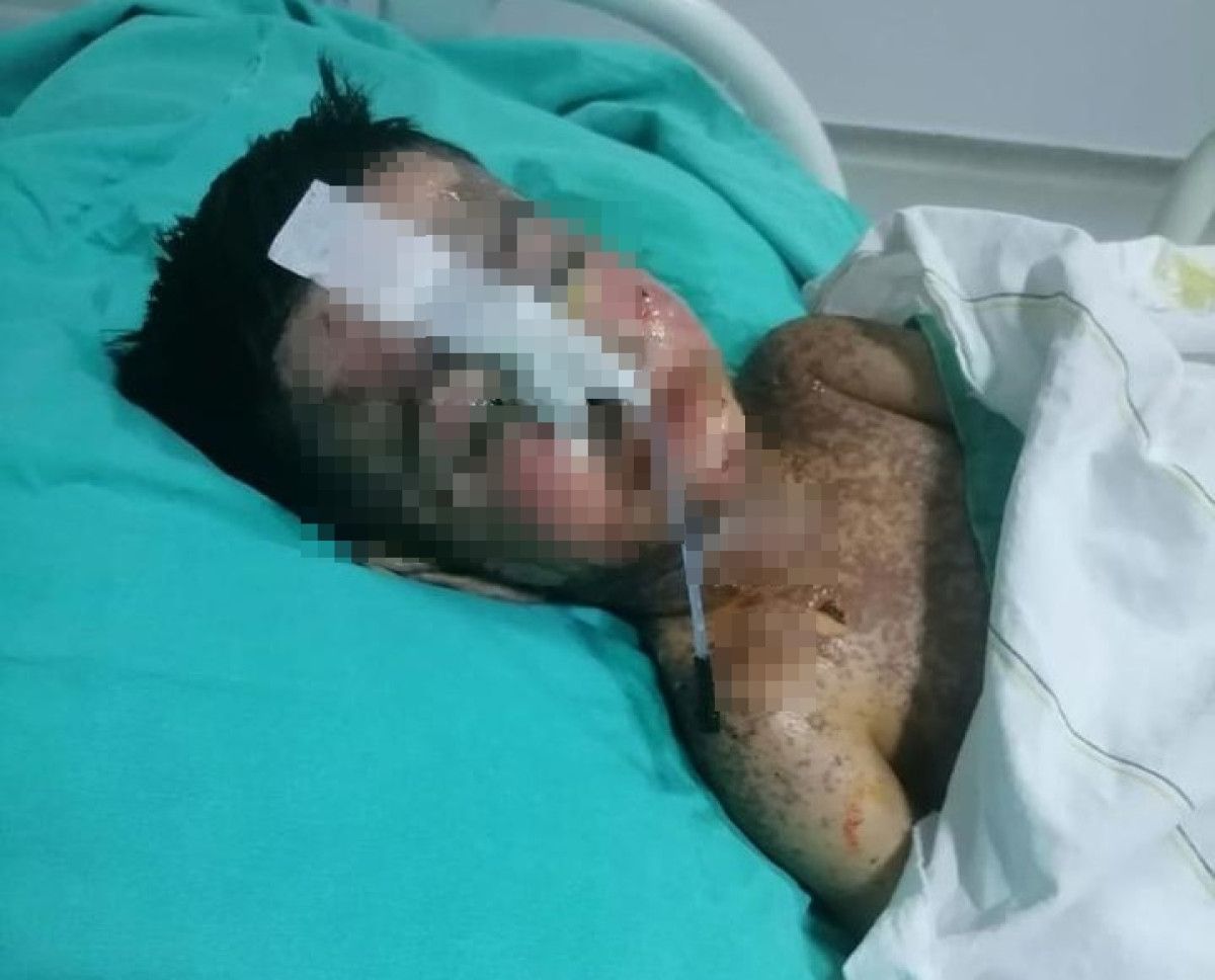 Hukuki Süreç ve Desteklenen Dava