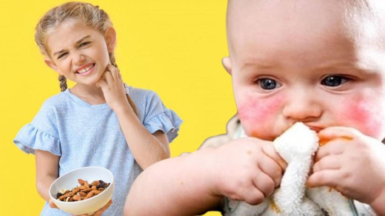 En Sık Görülen Besin Alerjileri ve Riskler