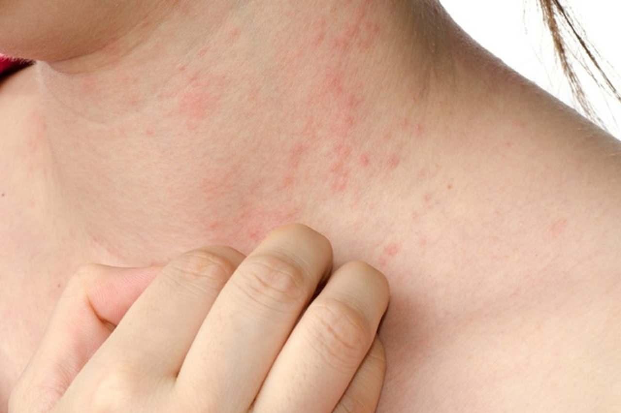 Temizlik ve Mutfak Hijyeni