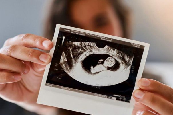 Uzman Uyarısı: Gebelikte 41. Haftadan Sonra Riskler Artıyor!