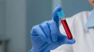 Uzmanların Açıklamasıyla Kan Gruplarına Özel Beslenme Rehberi: 0, A, B ve AB Kan Grupları Uyumlu ve Uzak Durulması Gerekenler