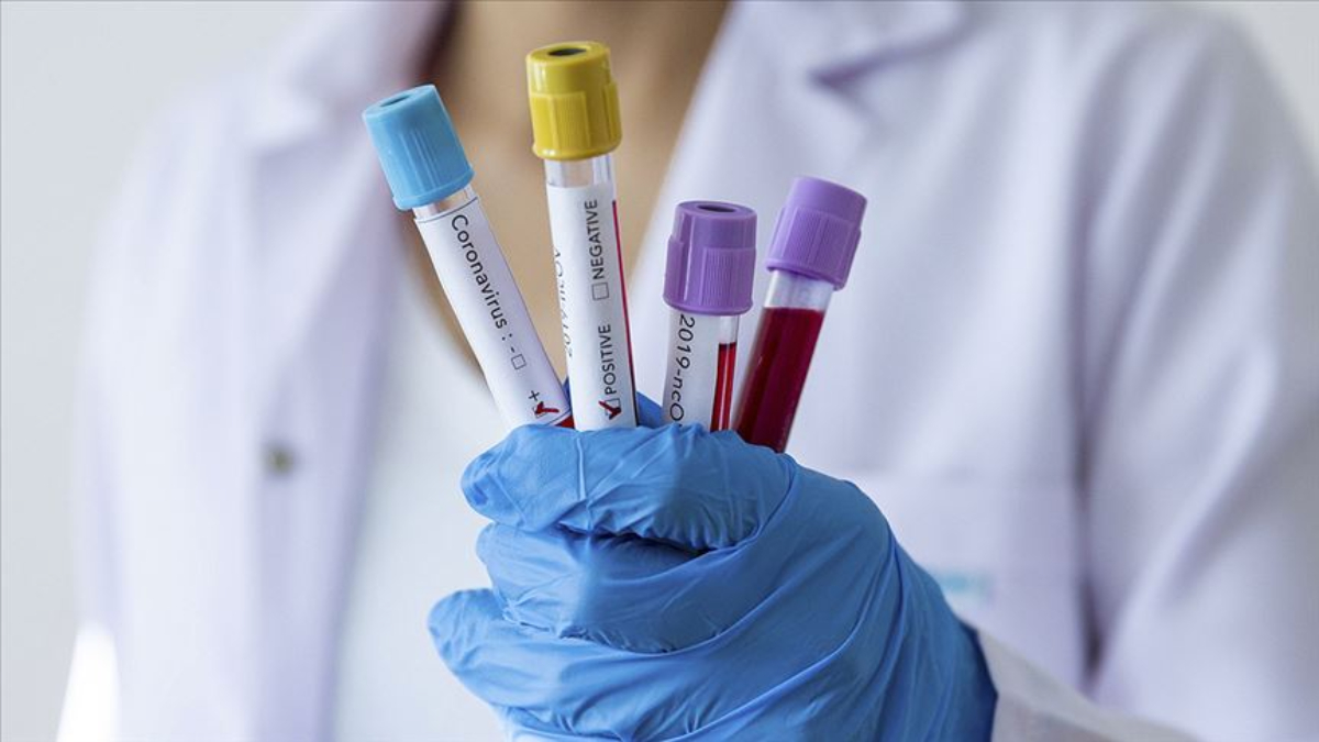 Frankenstein Varyantı ve Yayılma Süreci